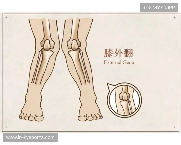 儿童O型腿、X型腿与运动项目选择关系 儿童O型腿、X型腿与运动项目选择关系